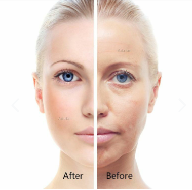 Masajeador Facial